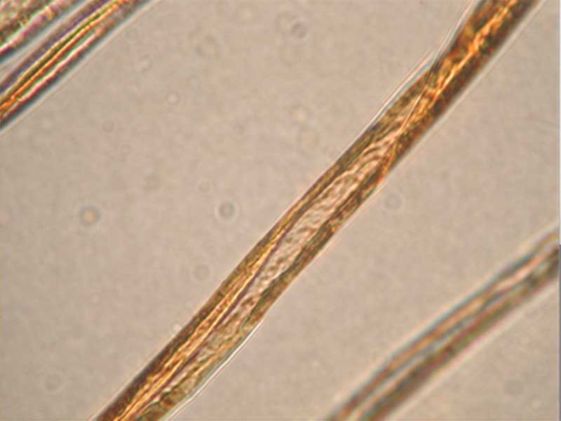 著色後の繊維側(cè)面の観察(綿)